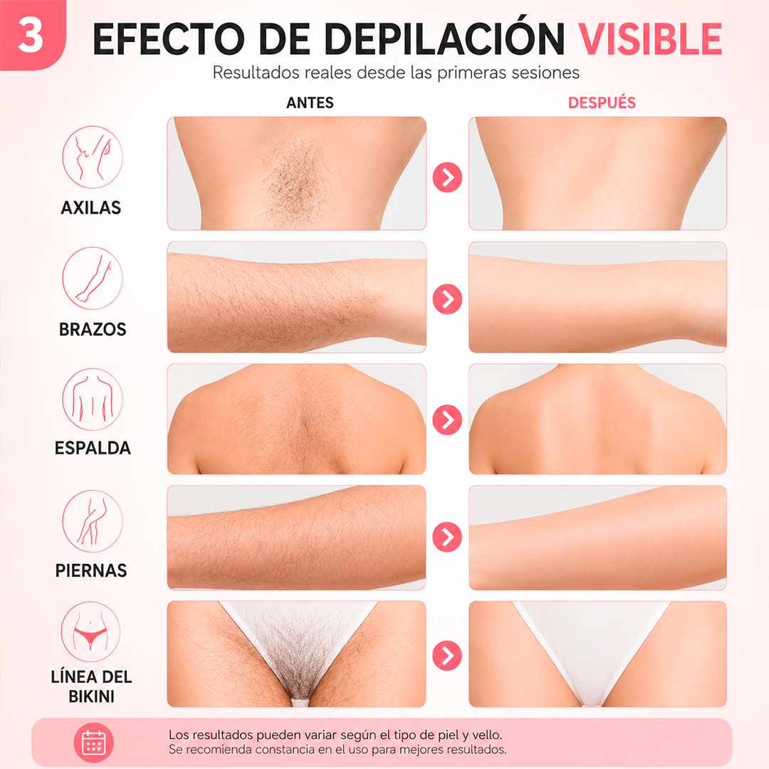 Depiladora Láser IPL PREMIUM